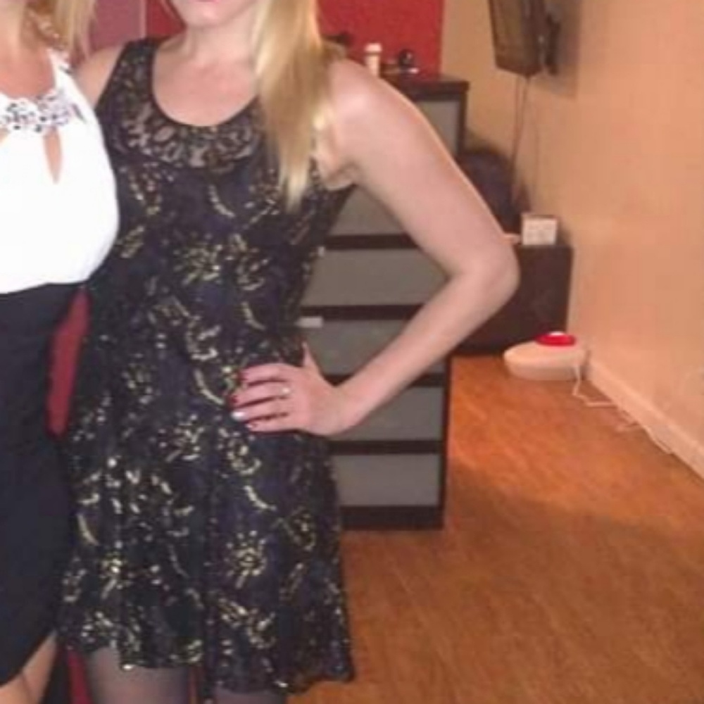 Black and Gold Lace Dress